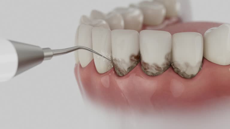 Reliable Emergency Dentist contractor in Pine Hills, CA by Smile Center Dentistry